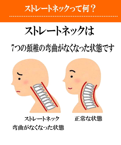 ストレートネックって何？