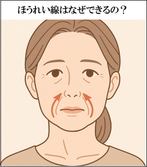 ほうれい線はなぜできるのか？イラスト