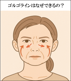 ゴルゴラインのイラスト