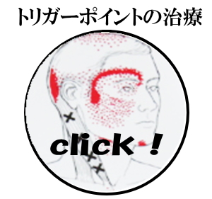 トリガーポイントの治療　案内バナー