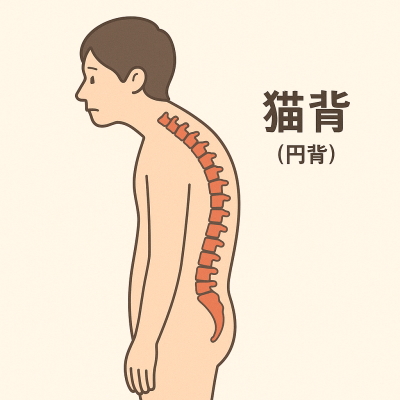 猫背の状態のイラスト