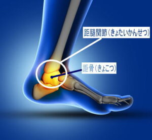 距腿関節と距骨のイラスト